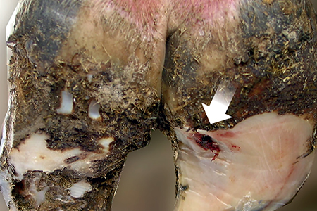 Sole ulcer